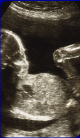 X-Ray