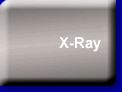Xray
